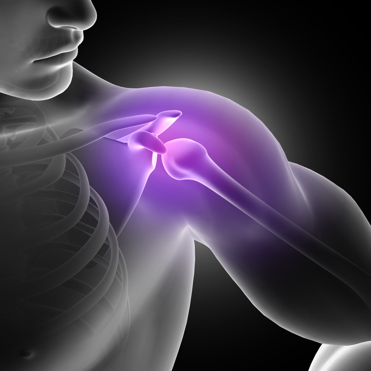 CAN POSTURE AFFECT SHOULDER IMPINGEMENT?